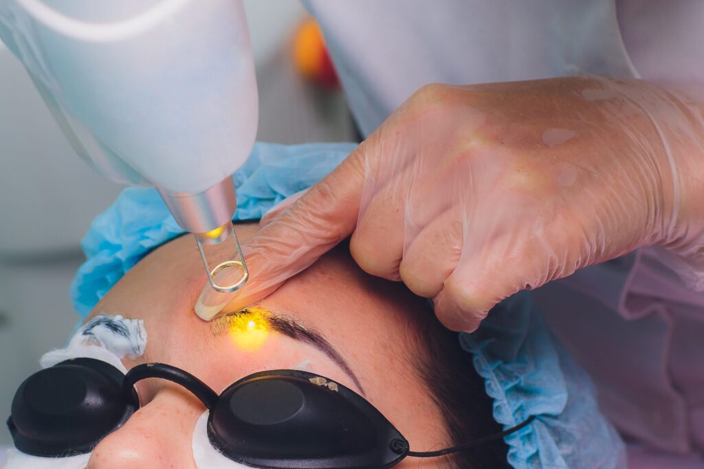 Détatouage Microblading Sourcil