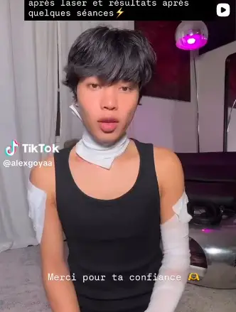 Alex Goya - TikTok Ambassade de Marque à Centre Laser Détatouage Paris