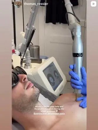 Pico Laser