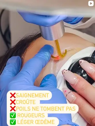 Detatouage Sourcils